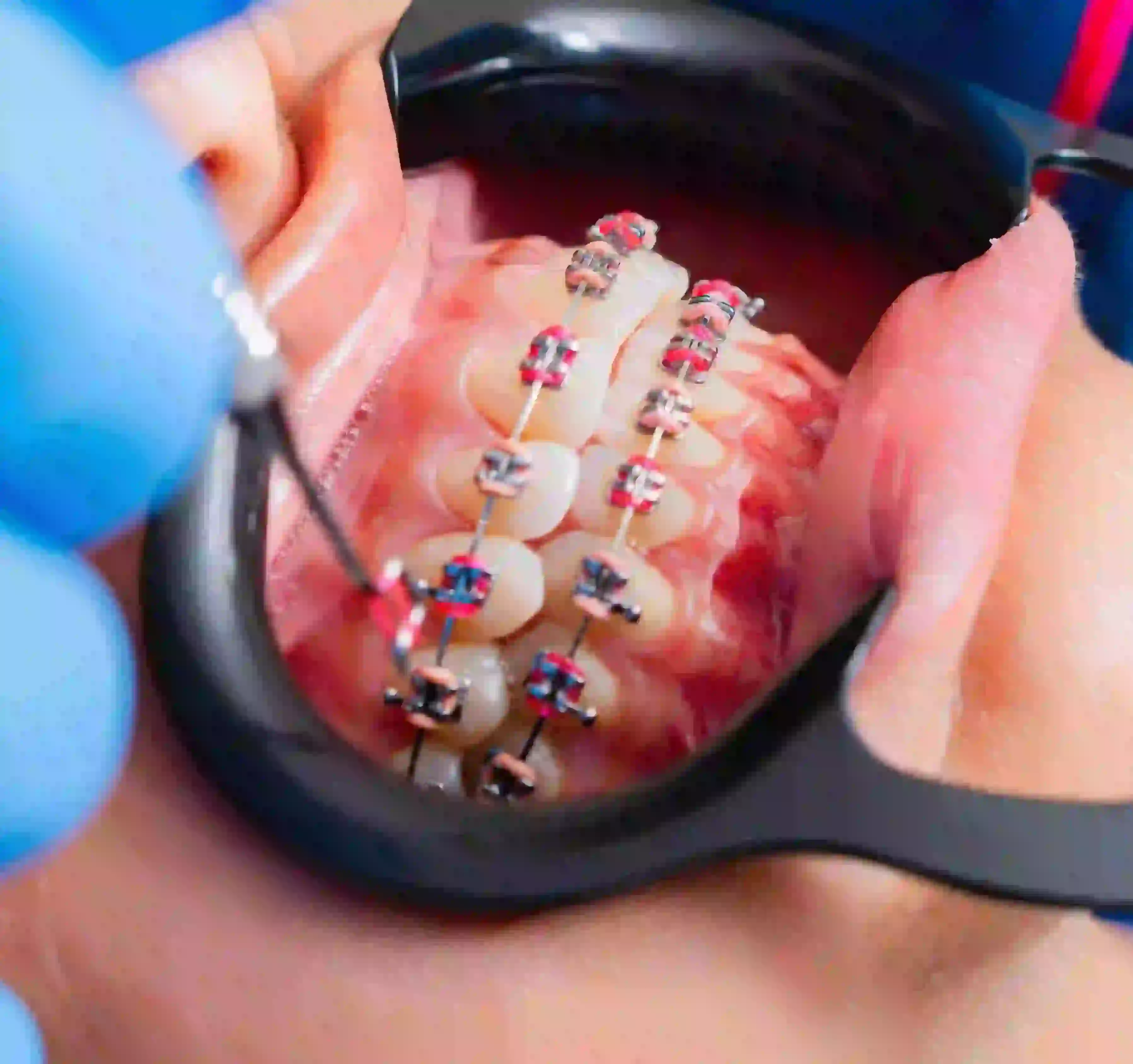Orthodontics service at PanOral Clinic