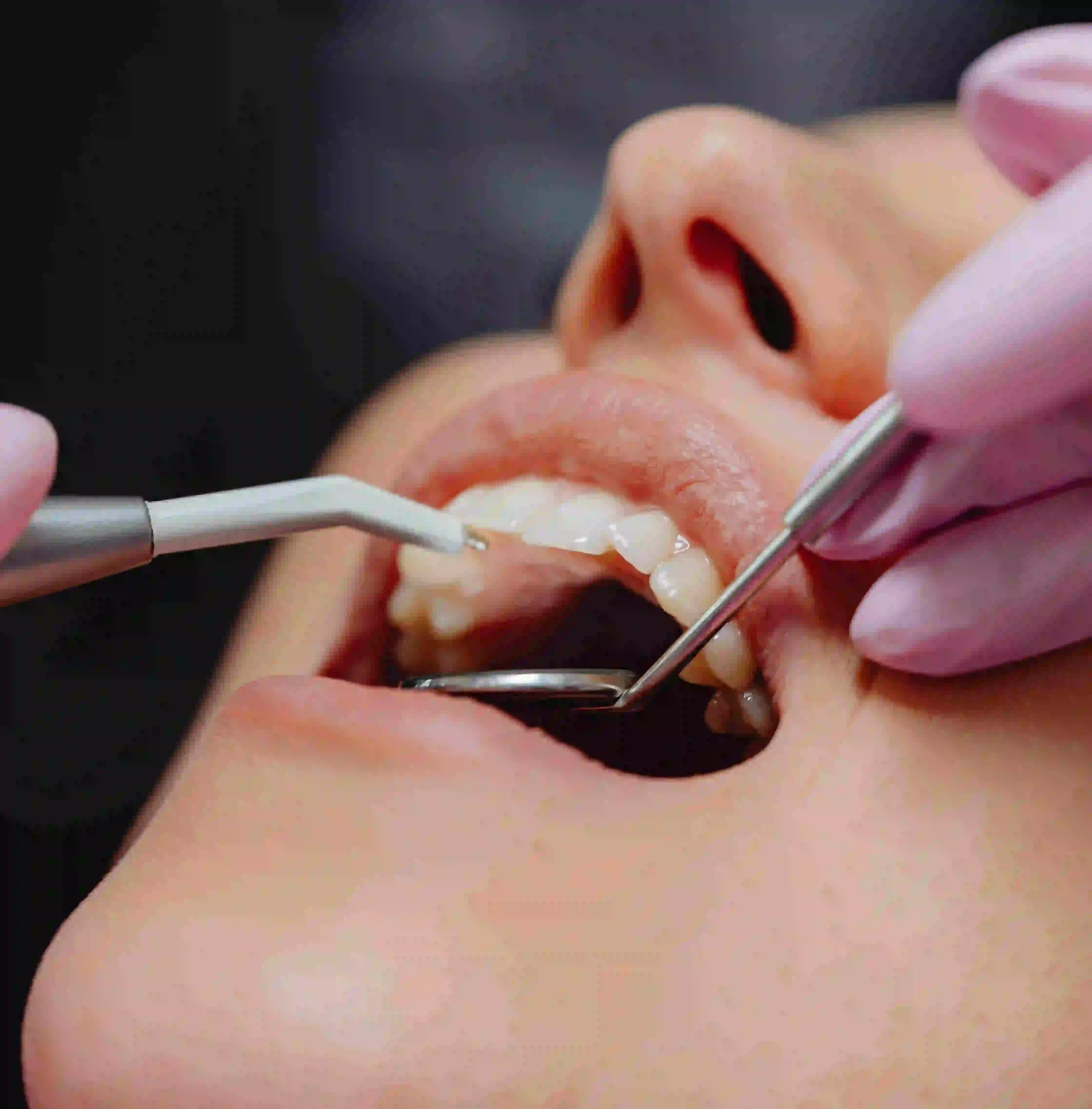 General Dentistry service at PanOral Clinic